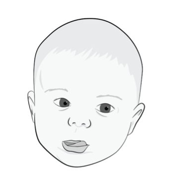 Visual Analysis – It’s Role in Determining Cranial Distortion/Subluxation Patterns